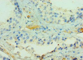 CSB-PA818715ESR1HU