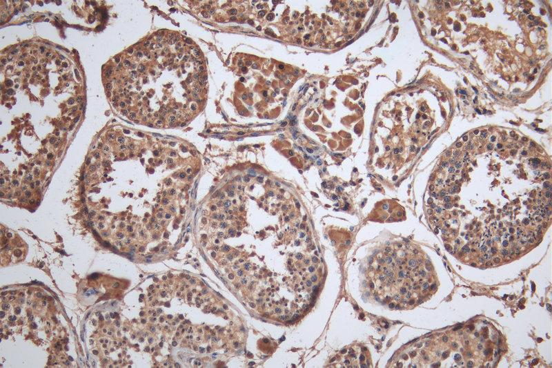 CSB-PA842761ESR1HU