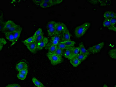 CSB-PA011821LA01HU