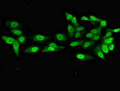 CSB-PA018779LA01HU