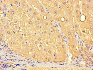 CSB-PA883371LA01HU
