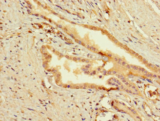 CSB-PA883371LA01HU