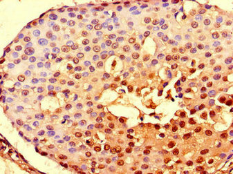 CSB-PA892153LA01HU
