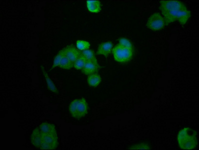 CSB-PA010287LA01HU
