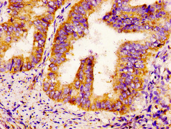 CSB-PA613605LA01HU