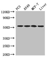 CSB-PA011821LA01HU