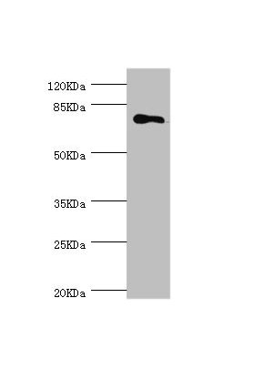 CSB-PA013773ESR1HU