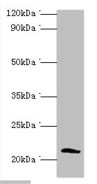 CSB-PA613674ESR2HU