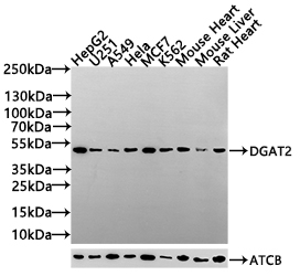 CSB-PA850407LA01HU