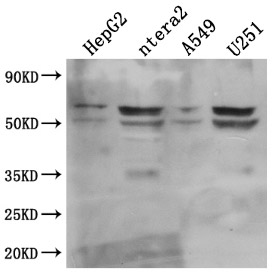 CSB-RA002831A0HU WB