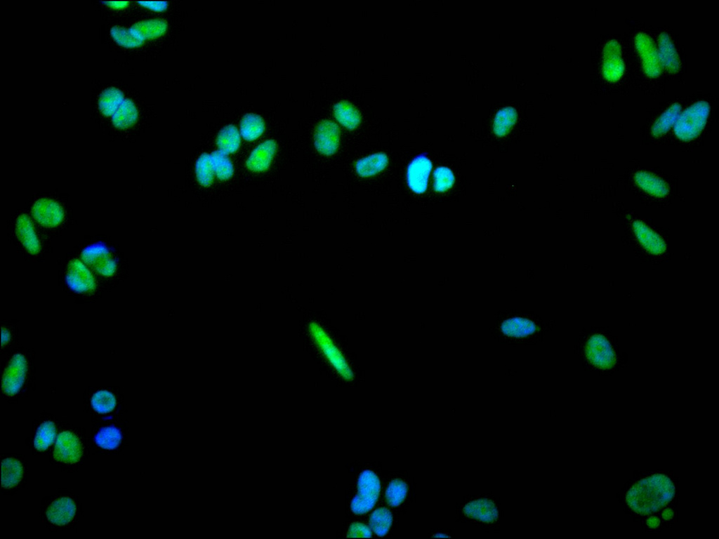 CSB-RA063930A0HU