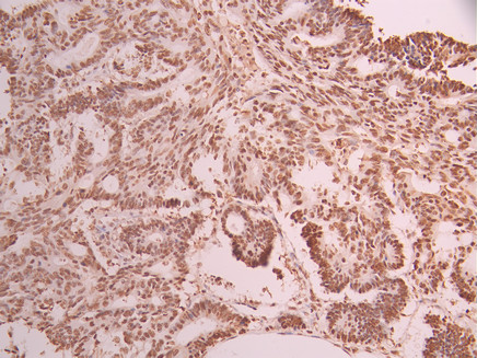 CSB-RA063930A0HU