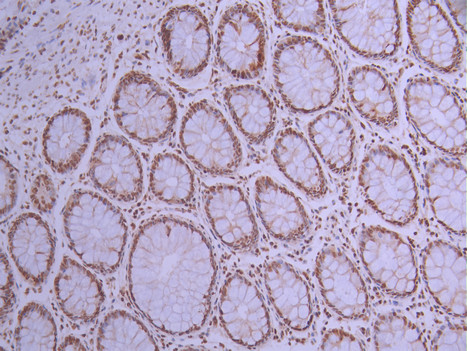 CSB-RA063930A0HU