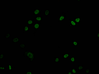 CSB-RA160202A0HU