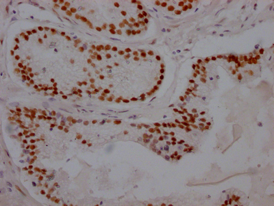 CSB-RA217661A0HU