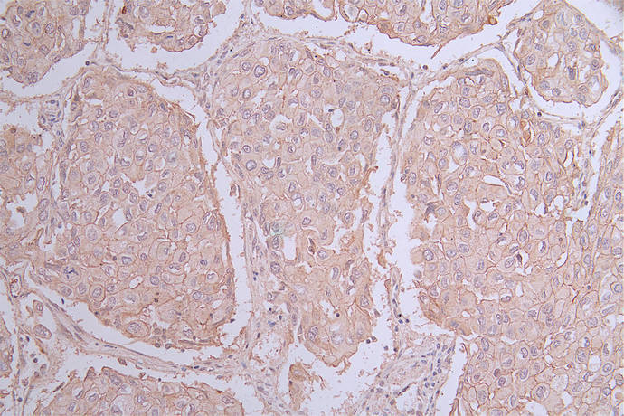 CSB-RA567944A0HU