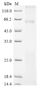 CSB-CF872417HU