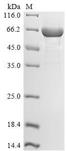 CSB-EP021760HU1