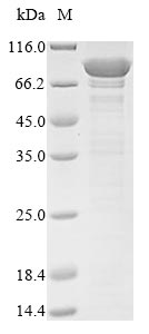 CSB-EP839401HU