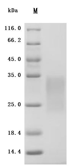 CSB-MP623829HU SDS-PAGE