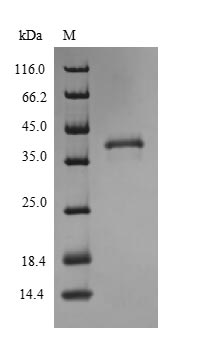 CSB-CF021575HU