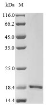 CSB-EP618634HU1